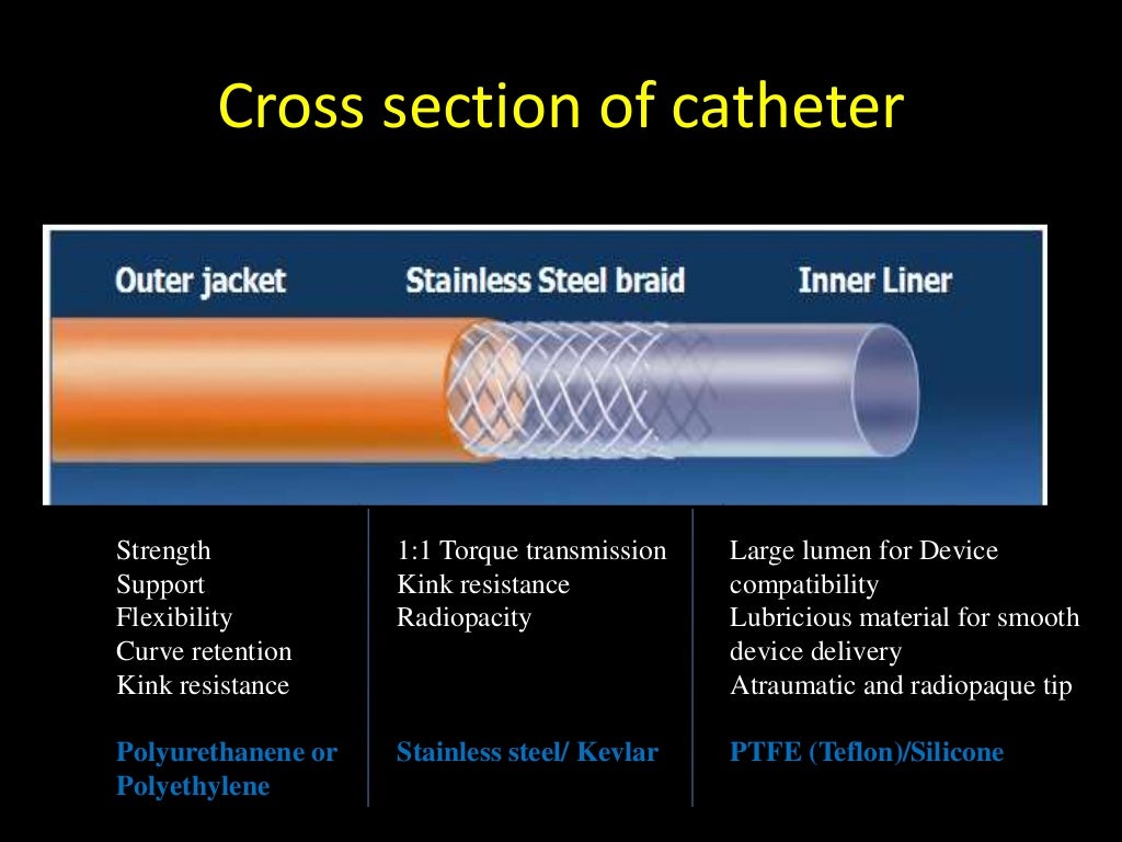 Choice of guiding catheters in PCI