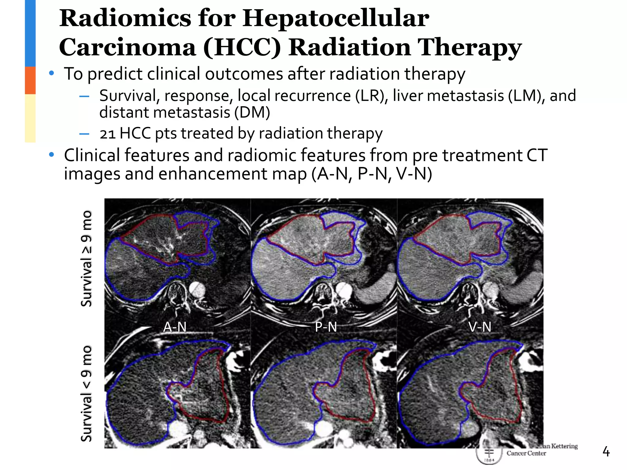 Radiomics for Hepatocellular
Carcinoma (HCC) Radiation Therapy
• To predict clinical outcomes after radiation therapy
– Survival, response, local recurrence (LR), liver metastasis (LM), and
distant metastasis (DM)
– 21 HCC pts treated by radiation therapy
• Clinical features and radiomic features from pre treatment CT
images and enhancement map (A-N, P-N,V-N)
A-N P-N V-N
Survival≥9moSurvival<9mo
4
 