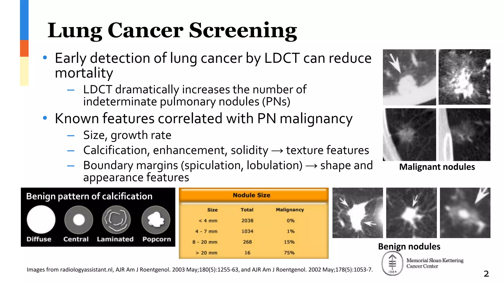 Normal Ldct Radiomics Analysis of Pulmonary Nodules in Low Dose CT for Early ...