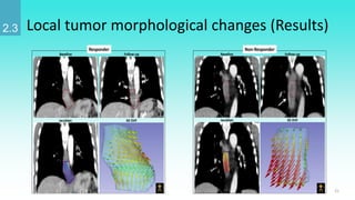 Quantitative image analysis for cancer diagnosis and radiation therapy ...
