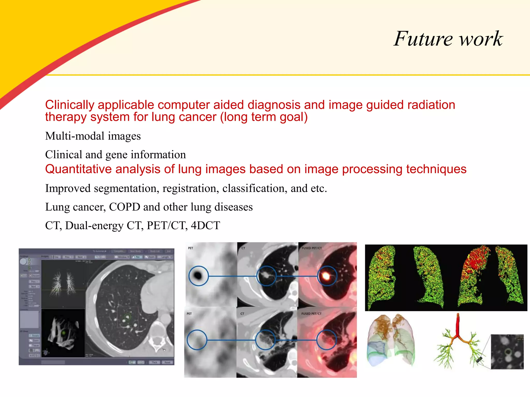 Future work 
Clinically applicable computer aided diagnosis and image guided radiation therapy system for lung cancer (long term goal) 
Multi-modal images 
Clinical and gene information 
Quantitative analysis of lung images based on image processing techniques 
Improved segmentation, registration, classification, and etc. 
Lung cancer, COPD and other lung diseases 
CT, Dual-energy CT, PET/CT, 4DCT  