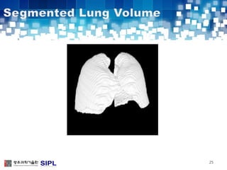 automatic detection of pulmonary nodules in lung ct images | PDF