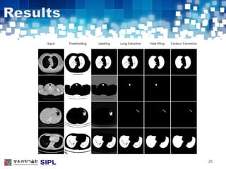 automatic detection of pulmonary nodules in lung ct images | PDF