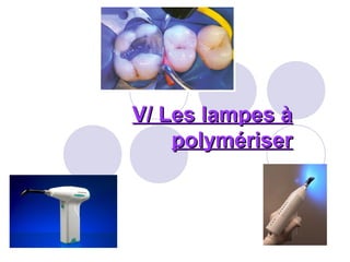 V/ Les lampes àV/ Les lampes à
polymériserpolymériser
 