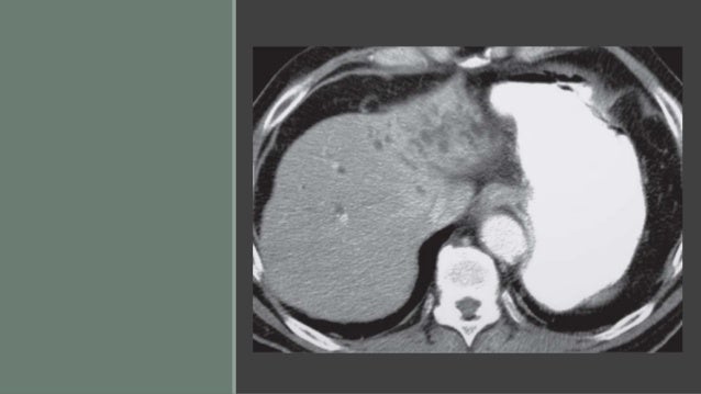 Alimentary Alimentary