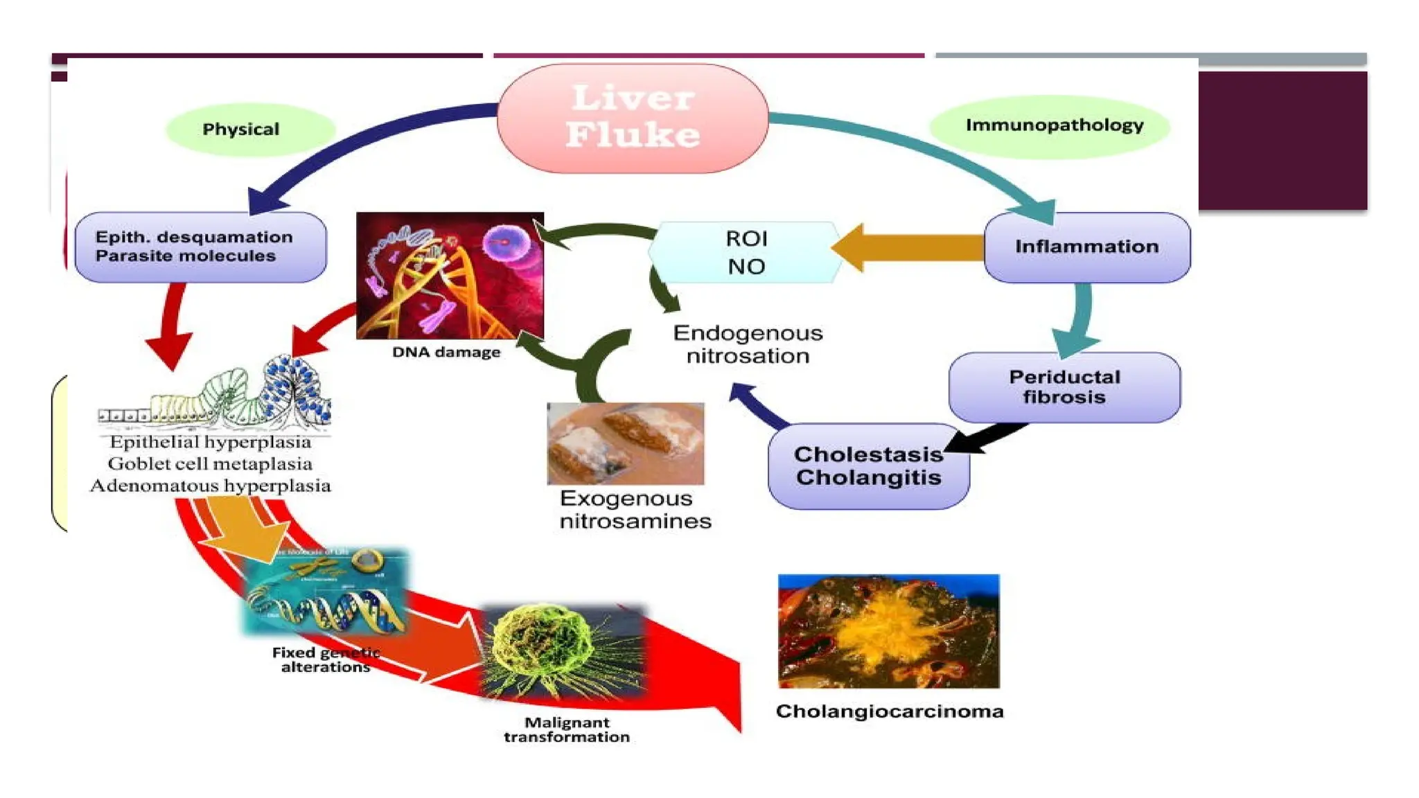 Cholangiocarcinoma, risk factors,types,clinical features,managment,ESMO ...