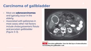 www.traditionalmedicine.com
• Most are adenocarcinomas
and typically occur in the
elderly.
• Associated with gallstones in
most cases; other risk factors
include cholecystoenteric fistula
and porcelain gallbladder
(Figure 3-3).
Carcinoma of gallbladder
 