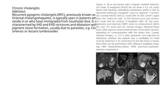 Chronic cholangitis
Infectious
Recurrent pyogenic cholangitis (RPC), previously known as
Oriental cholangiohepatitis, is typically seen in patients who
reside in or who have immigrated from Southeast Asia. It is
characterised by IHD and EHD strictures and dilatation with
pigment stone formation, usually due to parasites, e.g. Clonorchis
sinensis or Ascaris lumbricoides
 