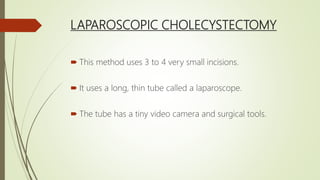 LAPAROSCOPIC CHOLECYSTECTOMY
 This method uses 3 to 4 very small incisions.
 It uses a long, thin tube called a laparoscope.
 The tube has a tiny video camera and surgical tools.
 