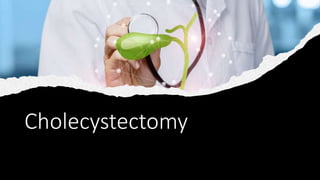 Cholecystectomy
 