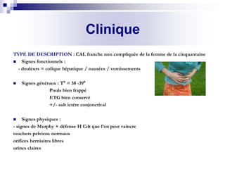 Signe Murphy Cholecystite aigue lithiasique | PDF