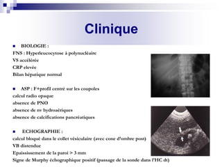 Signe Murphy Cholecystite aigue lithiasique | PDF