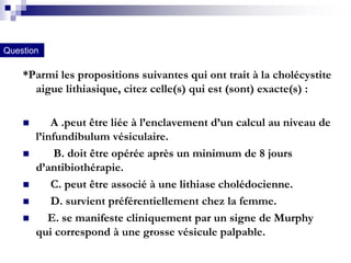 Signe Murphy Cholecystite aigue lithiasique | PDF