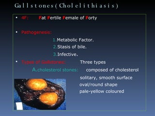 Gallstones(Cholelithiasis) <ul><li>4F:   F at  F ertile  F emale of  F orty </li></ul><ul><li>Pathogenesis: </li></ul><ul>...