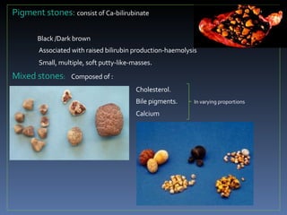 <ul><li>Pigment stones:  consist of Ca-bilirubinate </li></ul><ul><li>Black /Dark brown </li></ul><ul><li>Associated with ...