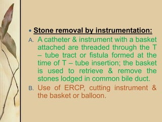  Stone removal by instrumentation:
A. A catheter & instrument with a basket
attached are threaded through the T
– tube tract or fistula formed at the
time of T – tube insertion; the basket
is used to retrieve & remove the
stones lodged in common bile duct.
B. Use of ERCP, cutting instrument &
the basket or balloon.
 