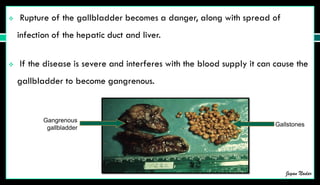 Gall Bladder Rapture Pathophysiology of Cholecystitis and cholelithiasis | PDF