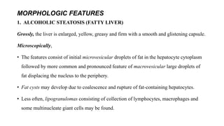 MORPHOLOGIC FEATURES
1. ALCOHOLIC STEATOSIS (FATTY LIVER)
Grossly, the liver is enlarged, yellow, greasy and firm with a smooth and glistening capsule.
Microscopically,
• The features consist of initial microvesicular droplets of fat in the hepatocyte cytoplasm
followed by more common and pronounced feature of macrovesicular large droplets of
fat displacing the nucleus to the periphery.
• Fat cysts may develop due to coalescence and rupture of fat-containing hepatocytes.
• Less often, lipogranulomas consisting of collection of lymphocytes, macrophages and
some multinucleate giant cells may be found.
 
