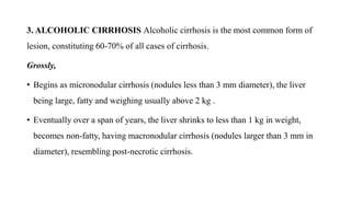 3. ALCOHOLIC CIRRHOSIS Alcoholic cirrhosis is the most common form of
lesion, constituting 60-70% of all cases of cirrhosis.
Grossly,
• Begins as micronodular cirrhosis (nodules less than 3 mm diameter), the liver
being large, fatty and weighing usually above 2 kg .
• Eventually over a span of years, the liver shrinks to less than 1 kg in weight,
becomes non-fatty, having macronodular cirrhosis (nodules larger than 3 mm in
diameter), resembling post-necrotic cirrhosis.
 