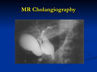 MR Cholangiography
MR Cholangiography
 