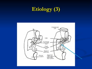 Etiology (3)
Etiology (3)
 