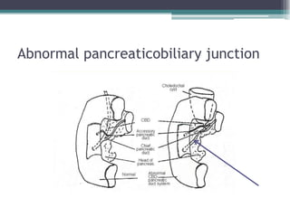 Abnormal pancreaticobiliary junction
 