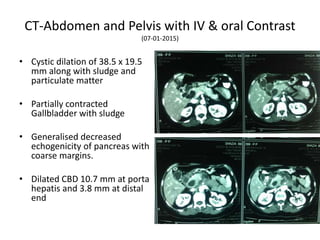 CT-Abdomen and Pelvis with IV & oral Contrast
(07-01-2015)
• Cystic dilation of 38.5 x 19.5
mm along with sludge and
particulate matter
• Partially contracted
Gallbladder with sludge
• Generalised decreased
echogenicity of pancreas with
coarse margins.
• Dilated CBD 10.7 mm at porta
hepatis and 3.8 mm at distal
end
 