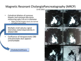 Magnetic Resonant CholangioPancreatography (MRCP)
13-01-2015
• Cylindrical dilation of common
hepatic and common bile ducts
measuring upto 3.8 cm in diameter
– Right and left heaptic ducts are normal
in calibre and outline
• Multiple small calculus signal
intensities noted dependently in
dilated CBD
• Confluence of intrapancreatic CBD
and pancreatic duct appears
unremarkable
Choledocholithiasis
 