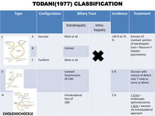 Type Configuration Biliary Tract Incidence Treatment
Extrahepatic Intra-
hepatic
I A Saccular Most or all >50 % to 75
%
Excision of
involved portion
of extrahepatic
tract + Roux-en-Y
Hepato-
jejunostomy
B Limited
C Fusiform Most or all
II Isolated
Diverticulum
Of CBD
5 % Excision with
closure of defect
over T-tube or
same as above
III Intraduodenal
Part of
CBD
5 % < 3 cm =
endoscopic
sphincterotomy
> 3cm = excision
via transduodenal
approachCHOLEDOCHOCELE
TODANI(1977) CLASSIFICATION
 