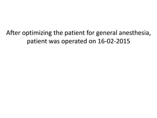 After optimizing the patient for general anesthesia,
patient was operated on 16-02-2015
 