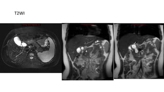 T2WI
 