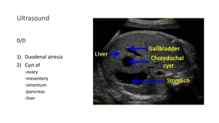 Ultrasound
D/D
1) Duodenal atresia
2) Cyst of
-ovary
-mesentery
-omentum
-pancreas
-liver
 