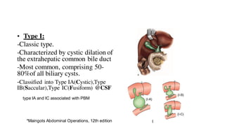 type IA and IC associated with PBM
• Type I:
-Classic type.
-Characterized by cystic dilation of
the extrahepatic common bile duct
-Most common, comprising 50-
80%of all biliary cysts.
-Classified into Type IA(Cystic),Type
IB(Saccular),Type IC(Fusiform) @CSF
*Maingots Abdominal Operations, 12th edition
 