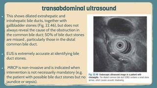 transabdominal ultrasound
● This shows dilated extrahepatic and
intrahepatic bile ducts, together with
gallbladder stones (Fig. 22.46), but does not
always reveal the cause of the obstruction in
the common bile duct; 50% of bile duct stones
are missed , particularly those in the distal
common bile duct.
● EUS is extremely accurate at identifying bile
duct stones.
● MRCP is non-invasive and is indicated when
intervention is not necessarily mandatory (e.g.
the patient with possible bile duct stones but no
jaundice or sepsis).
 