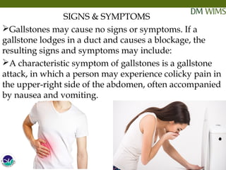 Cholelithiasis symptoms 2024