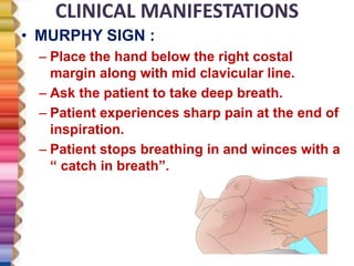 CLINICAL MANIFESTATIONS
• MURPHY SIGN :
– Place the hand below the right costal
margin along with mid clavicular line.
– Ask the patient to take deep breath.
– Patient experiences sharp pain at the end of
inspiration.
– Patient stops breathing in and winces with a
“ catch in breath”.
 