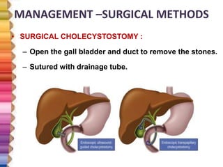 MANAGEMENT –SURGICAL METHODS
• SURGICAL CHOLECYSTOSTOMY :
– Open the gall bladder and duct to remove the stones.
– Sutured with drainage tube.
 
