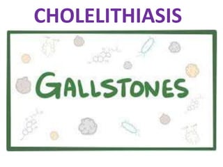 CHOLELITHIASIS
 