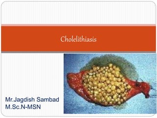 Mr.Jagdish Sambad
M.Sc.N-MSN
Cholelithiasis
 