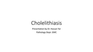 Cholelithiasis
Presentation by Dr. Hassan Yar
Pathology Dept. GMC
 
