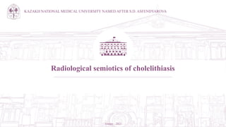 KAZAKH NATIONAL MEDICAL UNIVERSITY NAMED AFTER S.D. ASFENDYAROVA
Almaty - 2023
Radiological semiotics of cholelithiasis
 