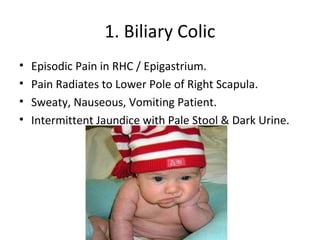 Cholelithiasis final year mbbs lecture | PPT