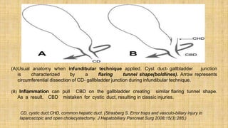 cholelithiasis-lecture.pptx