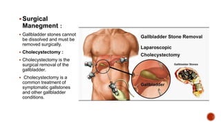 Surgical
Manegment :
 Gallbladder stones cannot
be dissolved and must be
removed surgically.
 Cholecystectomy :
 Cholecystectomy is the
surgical removal of the
gallbladder.
 Cholecystectomy is a
common treatment of
symptomatic gallstones
and other gallbladder
conditions.
 