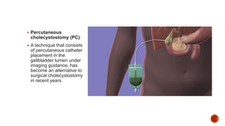  Percutaneous
cholecystostomy (PC):
 A technique that consists
of percutaneous catheter
placement in the
gallbladder lumen under
imaging guidance, has
become an alternative to
surgical cholecystostomy
in recent years.
 