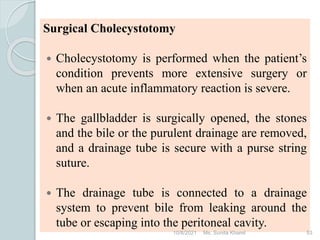 Cholelithiasis and cholecystitis, sunita kharel | PPTX