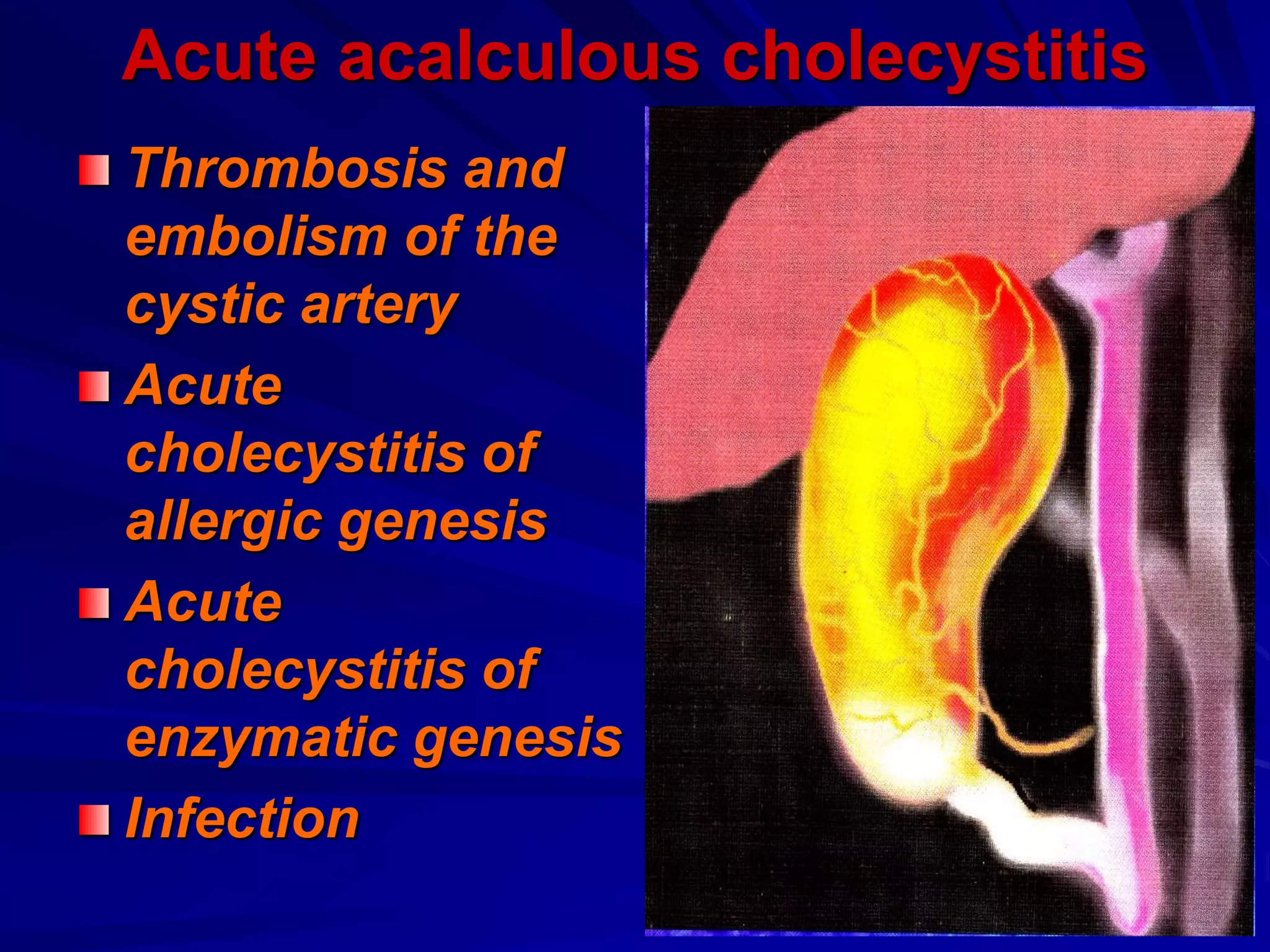 Acute acalculous cholecystitis
Thrombosis and
embolism of the
cystic artery
Acute
cholecystitis of
allergic genesis
Acute
cholecystitis of
enzymatic genesis
Infection
 