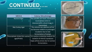 Colorless Colonies Vibrio cholera disease presentation slide | PPTX