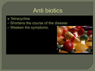  Tetracycline
 Shortens the course of the disease
 Weaken the symptoms.
 