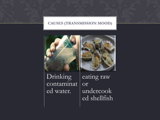 CAUSES (TRANSMISSION MOOD)




Drinking   eating raw
contaminat or
ed water.  undercook
           ed shellfish
 